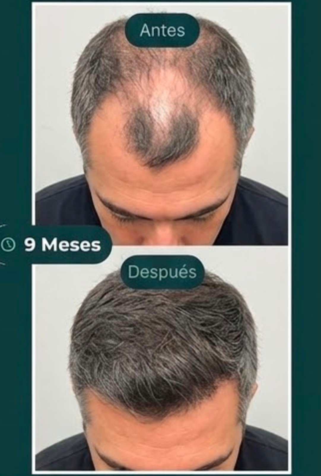 Resultado 2